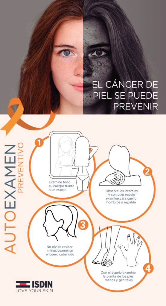 ¿Cómo te cuidas del Melanoma? mitos y verdades