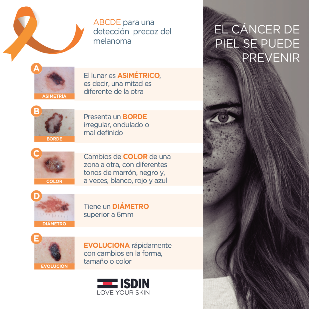 ¿Cómo te cuidas del Melanoma? mitos y verdades