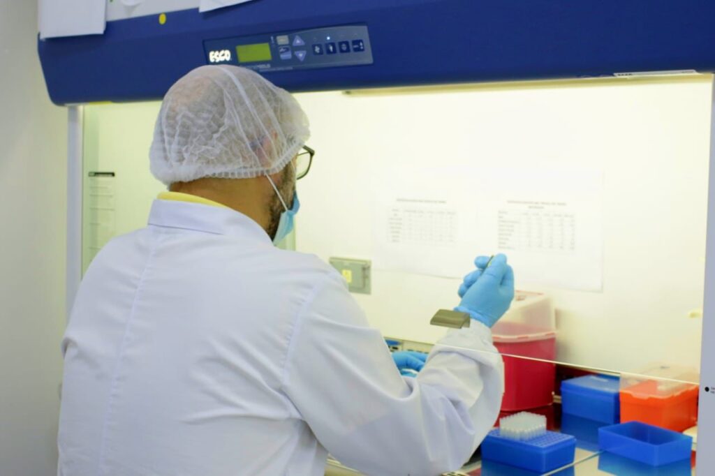 Laboratorio de Salud Pública del Atlántico realiza muestras de detección temprana de casos de viruela símica